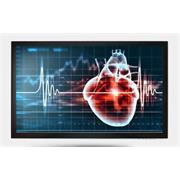 ONYX MEDDP-615HPN-A1-1010  LCD medical monitor